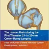 The Human Brain during the First Trimester 21- to 23-mm Crown-Rump Lengths: Atlas of Human Central Nervous System Development, Volume 4
