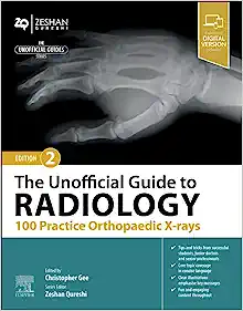 The Unofficial Guide to Radiology: 100 Practice Orthopaedic X-rays, 2nd edition