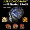 Timor’s Ultrasonography of the Prenatal Brain, 4th edition
