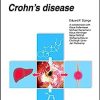 Ulcerative colitis – Crohn’s disease (UNI-MED Science)