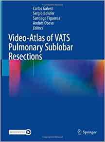 Video-Atlas of VATS Pulmonary Sublobar Resections ()