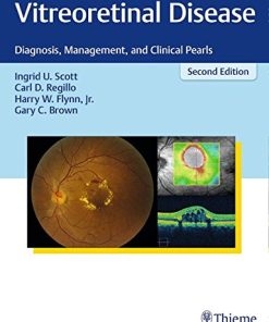 Vitreoretinal Disease: Diagnosis, Management, and Clinical Pearls, 2nd Edition ()