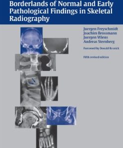 Koehler/Zimmer’s Borderlands of Normal and Early Pathological Findings in Skeletal Radiography, 5th edition